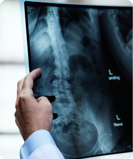 Radiografies