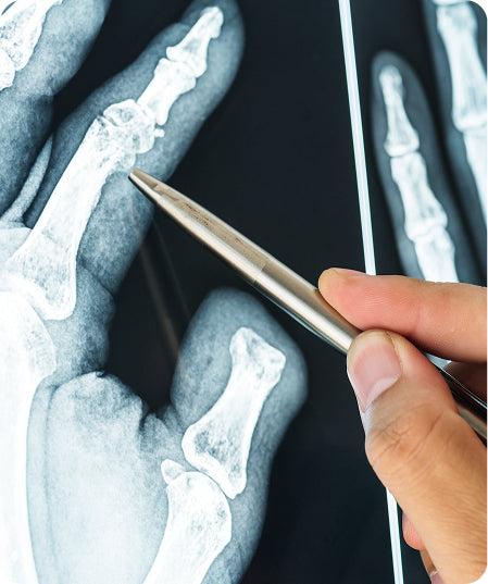 Radiografia d'Extremitats Superiors o Inferiors