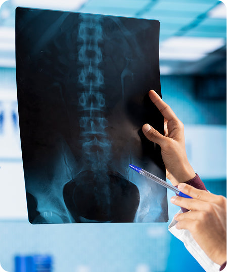 Radiografia de columna