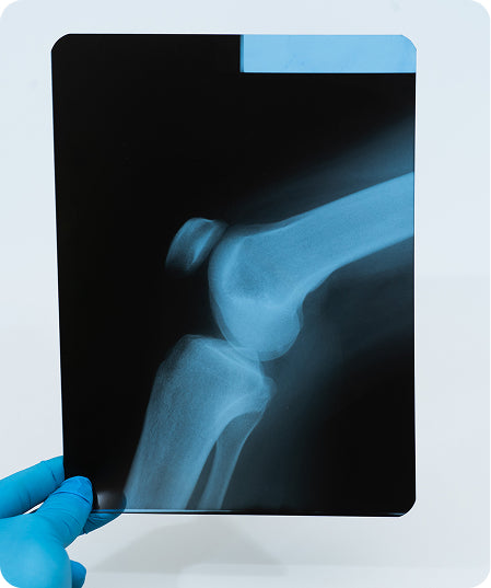 Radiografia de genoll