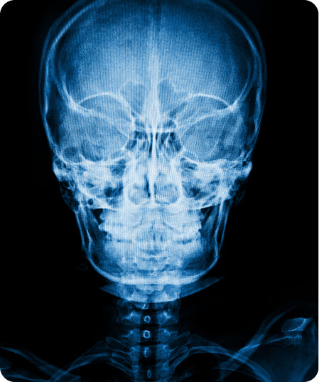 Radiografia del crani