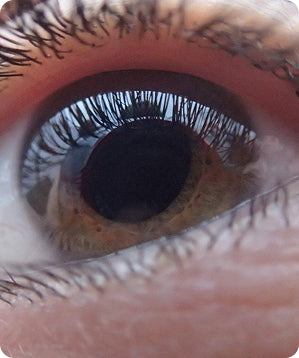 Paquimetria corneal