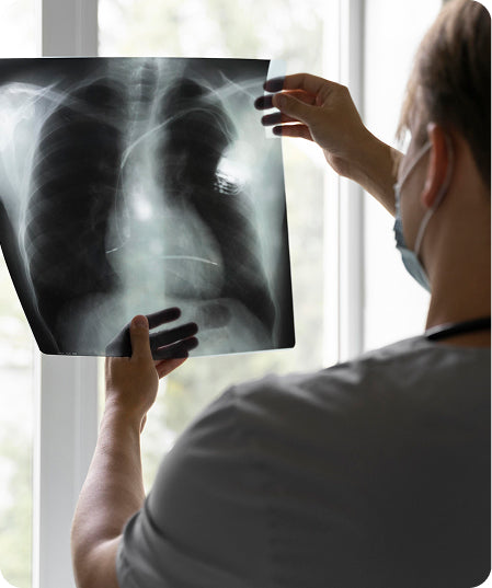 Radiografia de tòrax
