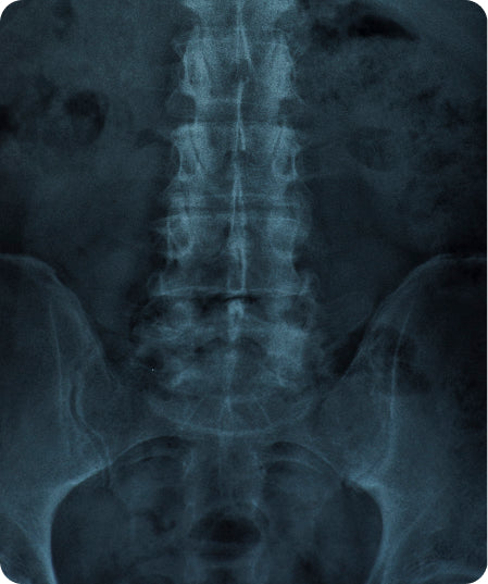 Radiografia de pelvis (1 projecció)