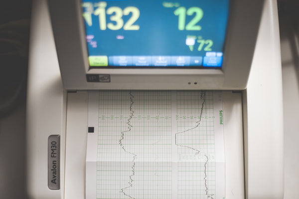Electrocardiograma (ECG)